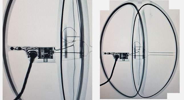 Coils under X-Ray.